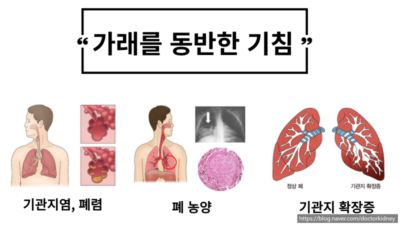 마른기침, 가래, 자연치유가 불가능하여