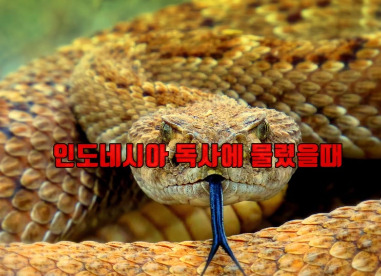  인도네시아에서 독사에게 물렸을때 뱀독혈청 병원