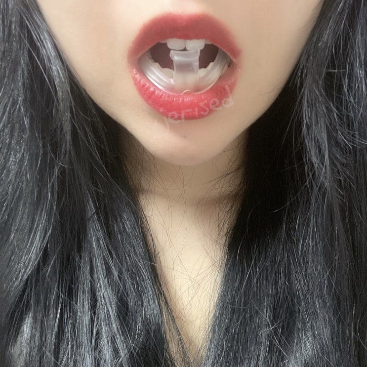  이갈이 코잠 마우스피스 2주 사용해 본 후기 (효과 있음!!!)