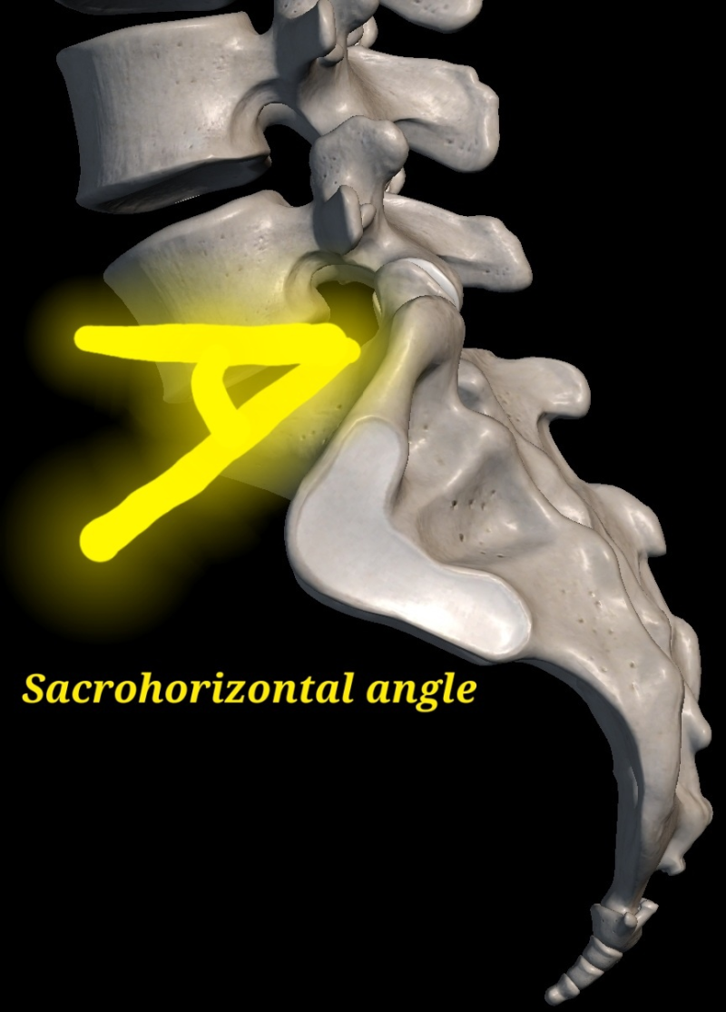 Iliopsoas (장요근, 엉덩허리근) : Iliacus + Psoas Major (장골근 + 대요근) : 네이버 블로그