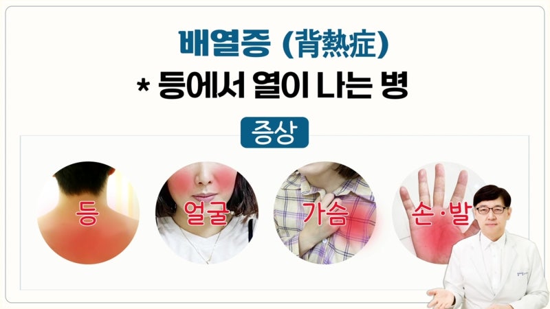 등에열이나요!!! 등에열 배열, 배열증과 등이뜨거운이유, 등에열이나는이유