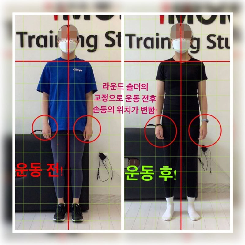 청주pt! 청주자세교정으로 어깨통증