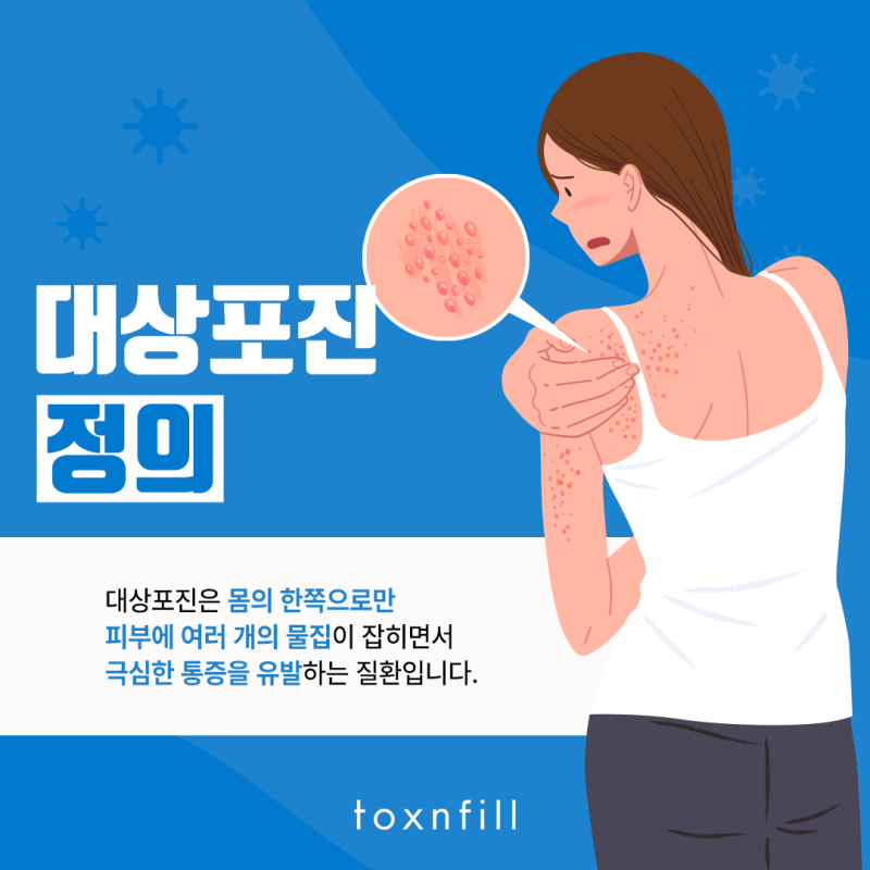 인천대상포진예방접종병원 '톡스앤필 구월점'