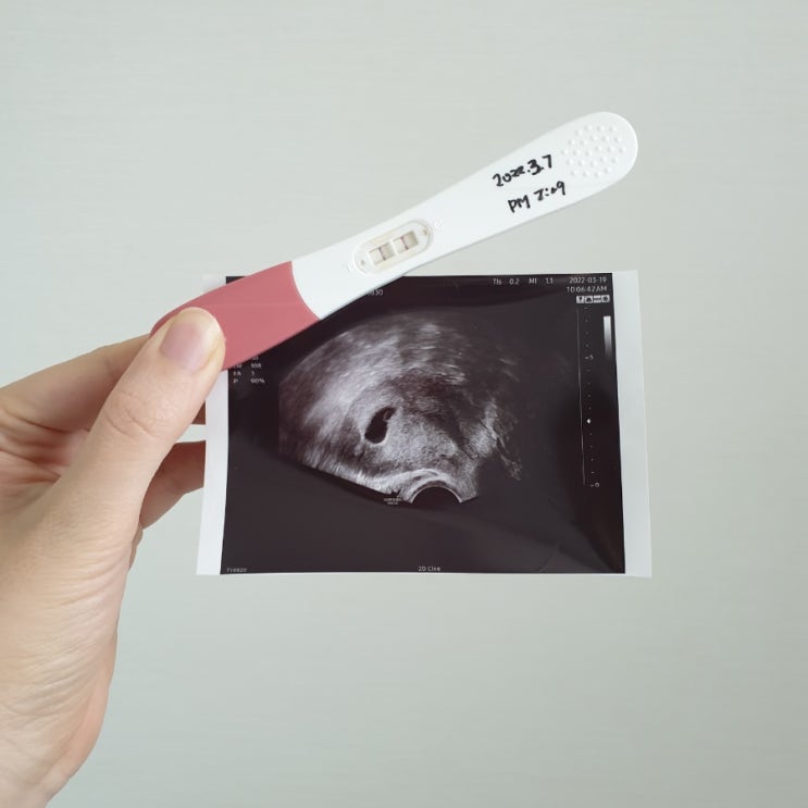  임신일기① 임신테스트기 2줄확인.. 산전진료보기 5주차 아기집 확인 (도봉구 에이치큐브병원)
