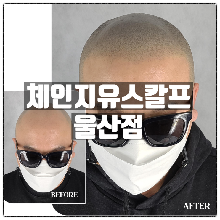 체인지유스칼프 울산점 울산탈모관리 울산두피문신 전문점 체인지유스칼프 울산점 울산탈모관리 울산두피문신 전문점