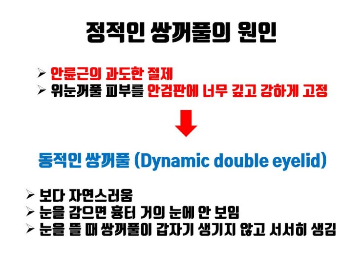  부자연스러운 쌍꺼풀, 깊은 쌍꺼풀, 소시지 쌍꺼풀은 동적인 쌍꺼풀로 해결할 수 있어요!!