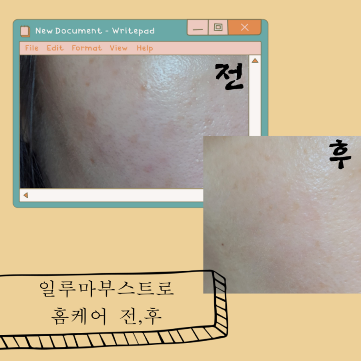  얼굴기미없애는방법 홈케어 가능한 미백세럼 추천!