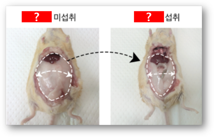 중성지방 낮추는법 총정리 &lt;질병퇴치본부&gt;