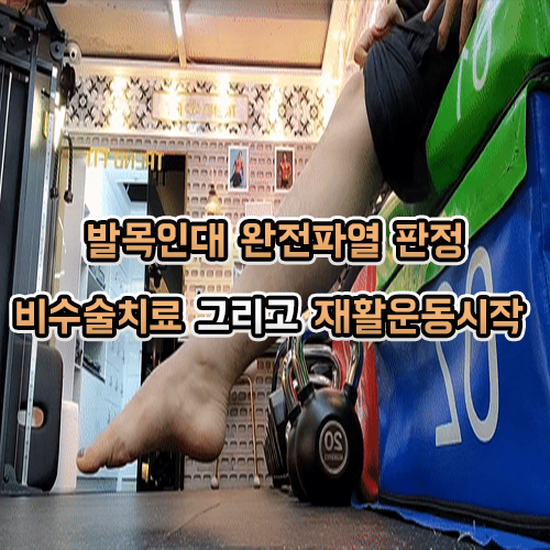 발목인대 완전파열 재활 운동하기 1편 깁스에서 발가락 운동!