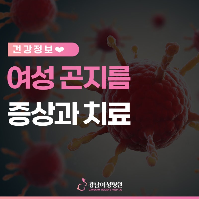 여성곤지름 증상, 치료를 미루지 마세요!