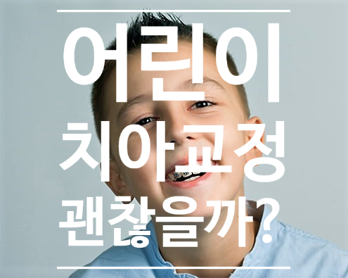 하남 어린이 부정교합 치아교정 괜찮을까? 미성숙 영구치 교정 시 걱정하시는 점에 대한 이야기 하남 어린이 부정교합 치아교정 괜찮을까? 미성숙 영구치 교정 시 걱정하시는 점에 대한 이야기