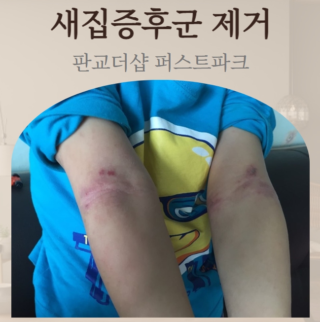  새집증후군 두드러기 아토피 예방하기!  판교더샵 퍼스트 파크~