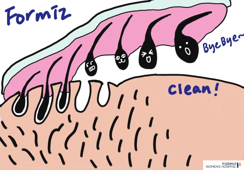 산부인과 전문 임산부 제모 왁싱 음모 회음부