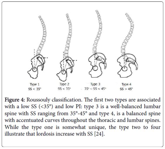  Biomechanical analysis of the spino-pelvic organization and adaptation in pathology(논문 정리)