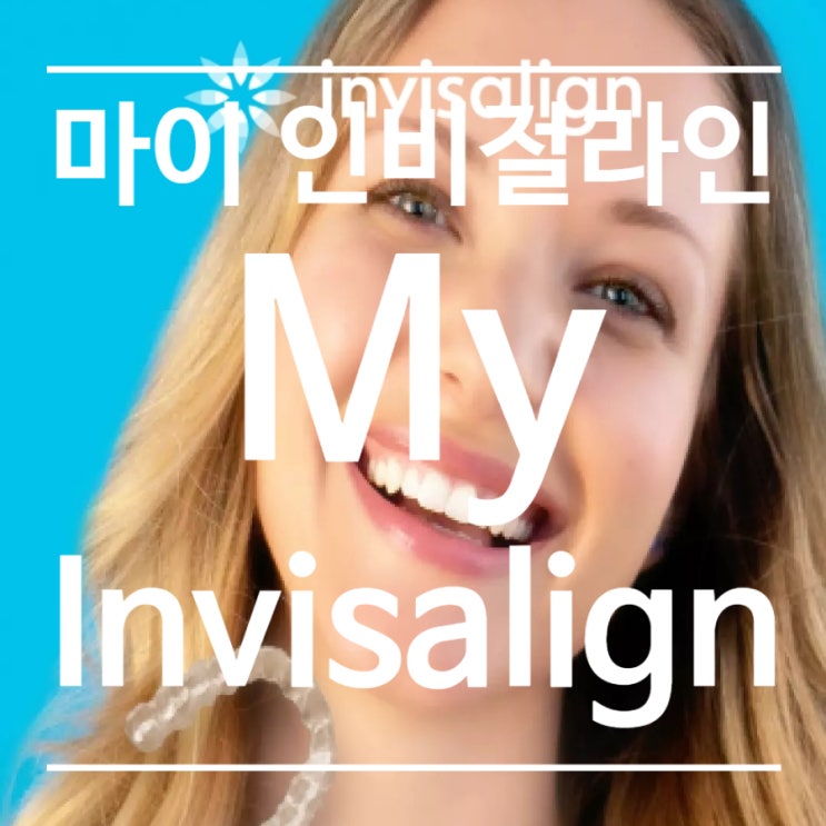 마이 인비절라인(My invisalign) 앱을 활용한 투명교정 장치 착용 관리