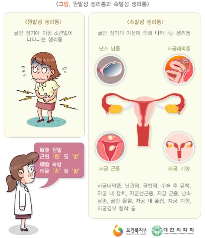 창원생리통 진통제말고 한약으로 치료하세요