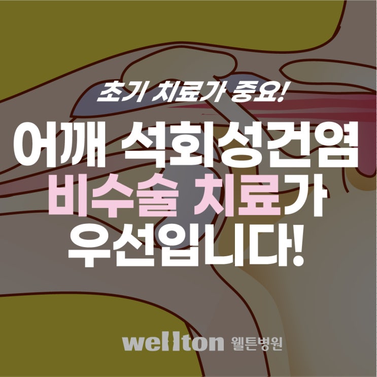  [강서구 마곡] 어깨 석회성건염 치료, 비수술적 보존치료가 우선!