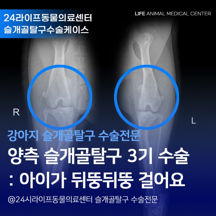 대구 강아지 양측 슬개골탈구 3기 수술 : 강아지가 뒤뚱뒤뚱 걸어요! 대구24시동물병원 라이프동물의료센터