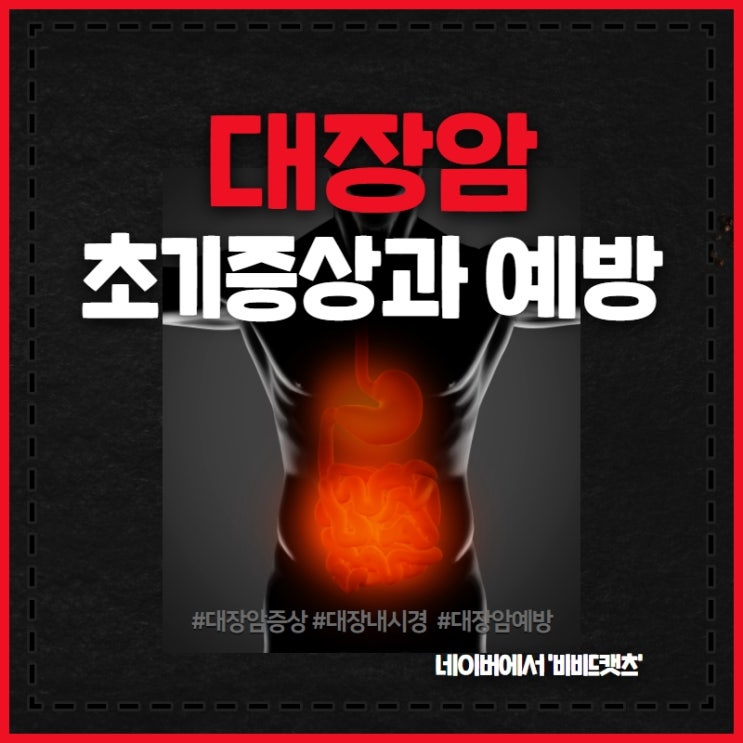 대장암 예방을 위해선 정기적인 내시경이 최고