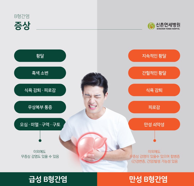급성 B형 간염의 증상과 치료