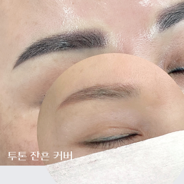  천안눈썹문신, 이후에 생긴 잔흔때문에 걱정이시죠?