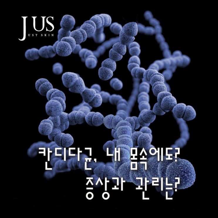  칸디다균, 내 몸속에도? 증상과 관리는?