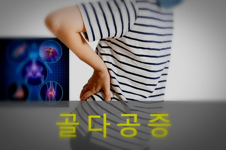  골다공증 원인과 증상, 예방, 좋은 음식, 영양제