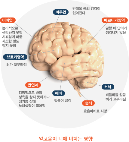 알코올 중독이란? 알코올 중독이란?
