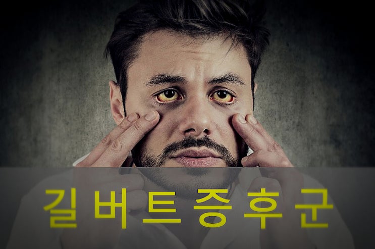  길버트(질베르) 증후군 원인과 증상, 예방