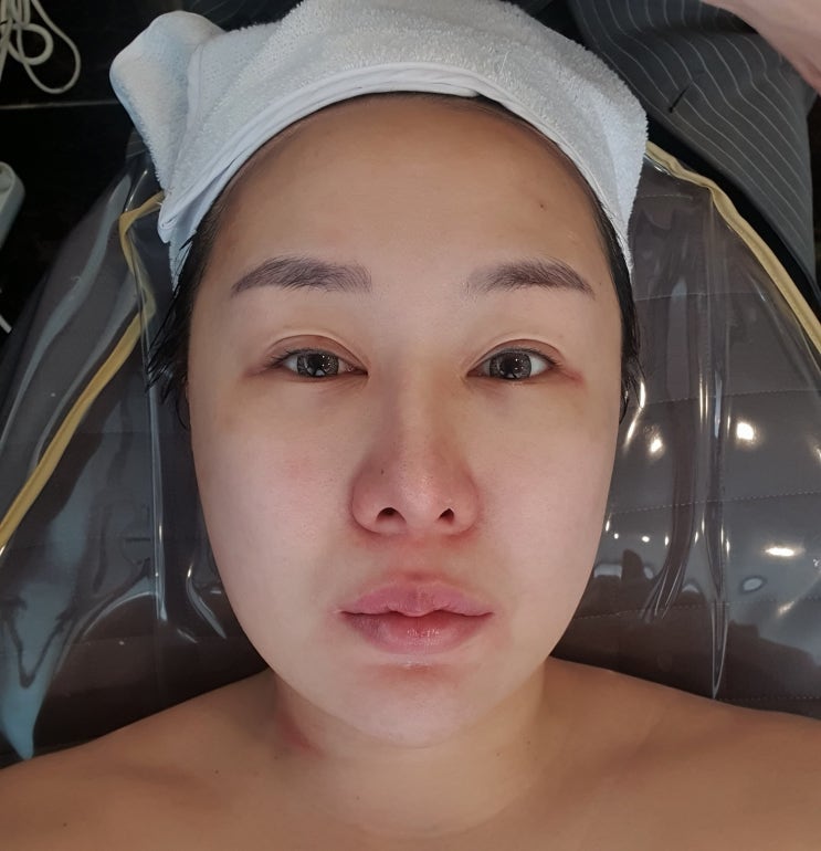  마들역 피부관리 거꾸로가는시간 물광케어 받고 왔움