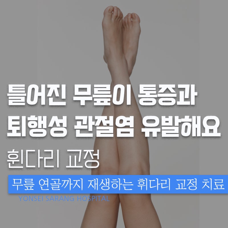 오다리교정수술 O자형 휜 다리에 9