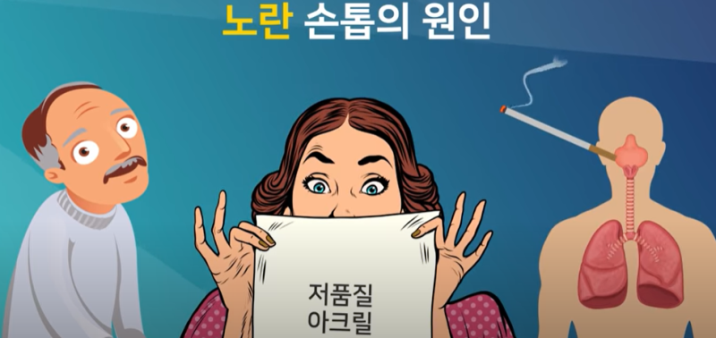 손톱 / 손톱깎는 꿈 / 손톱 세로줄 / 꿈해몽