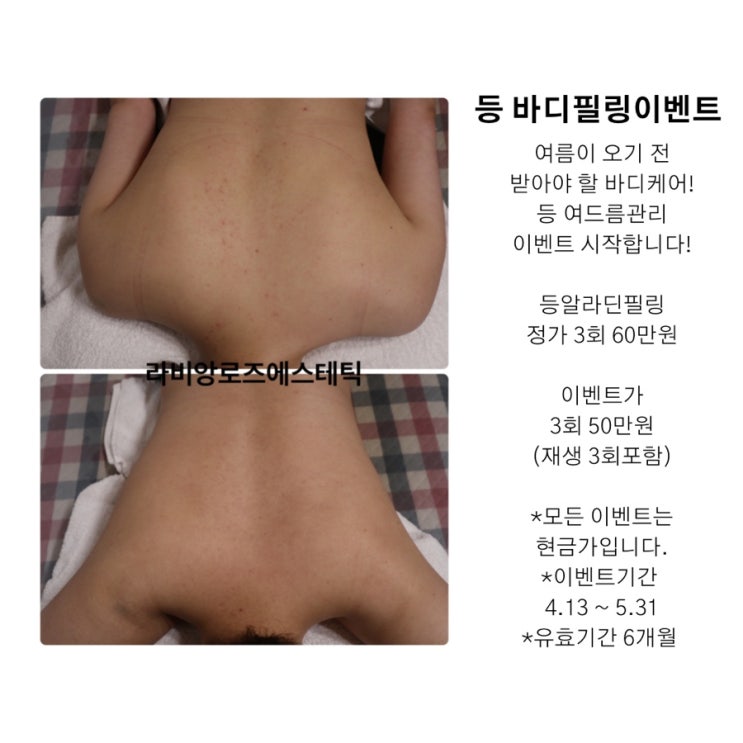  알라딘필링 이벤트 여름되기 전 깨끗한 등만들어보세요.