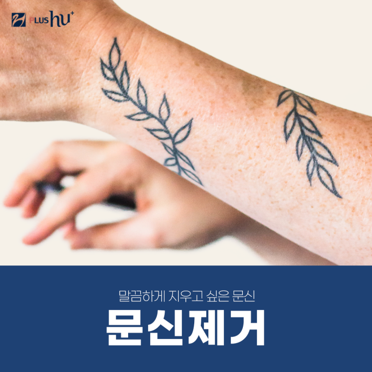  [타투제거] 가격(비용) 고민하고 있다면