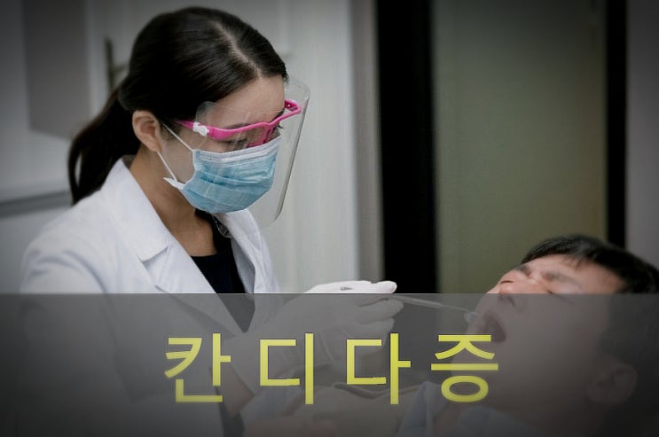  칸디다증 원인과 증상, 예방, 좋은 음식