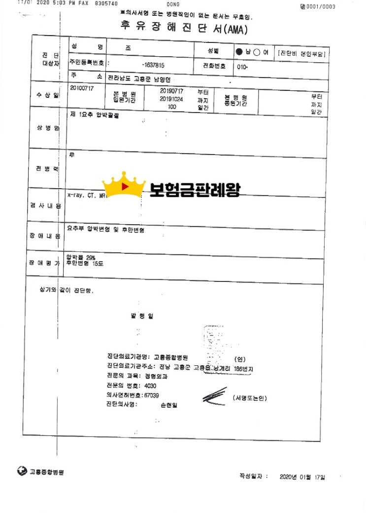  후방추돌로 척추압박 골절 사례