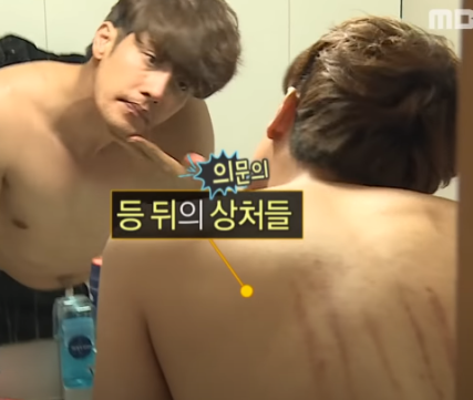 나혼자산다 성훈 키스마크 하차 진실 나혼자산다 성훈 키스마크 하차 진실