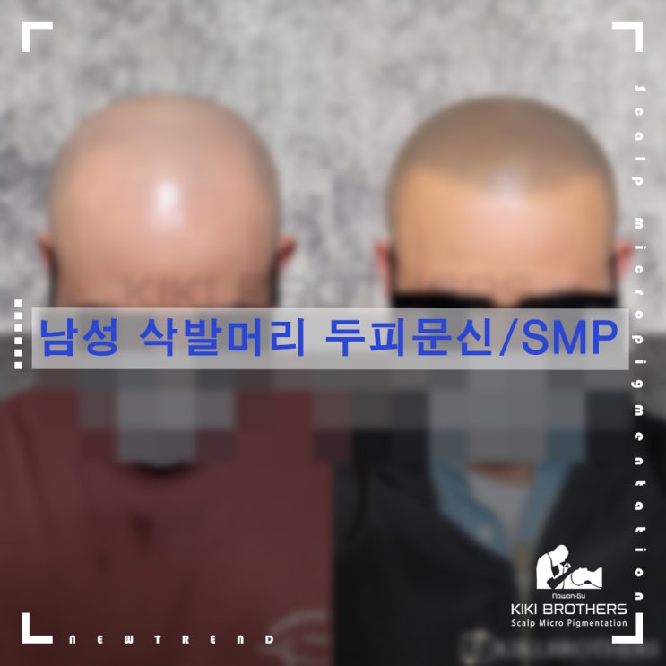  태릉 탈모커버!!정수리,가르마,삭발머리까지!! 탈모커버 전문점  키키브라더스 노원
