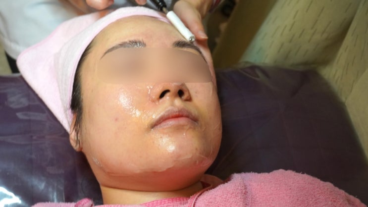  마곡한의원 사춘기여드름 효과적으로 치료받아요