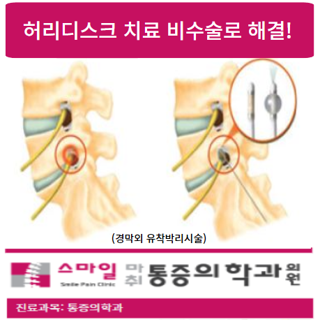  [일산허리통증치료병원] 허리디스크치료 비수술로 해결하세요!