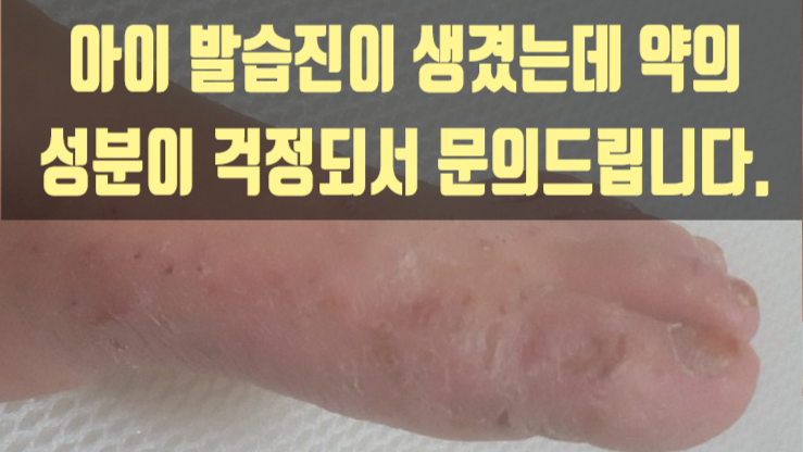  아이 발습진이 생겼는데 약의 성분이 걱정되서 문의드립니다.