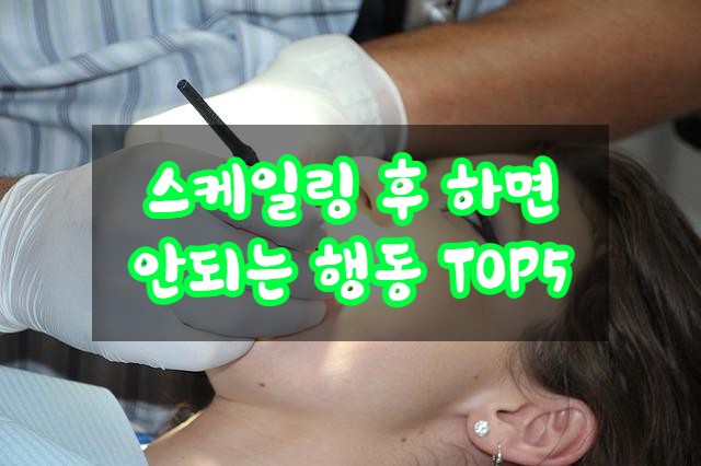 스케일링 후 하면 안되는 것 TOP 5