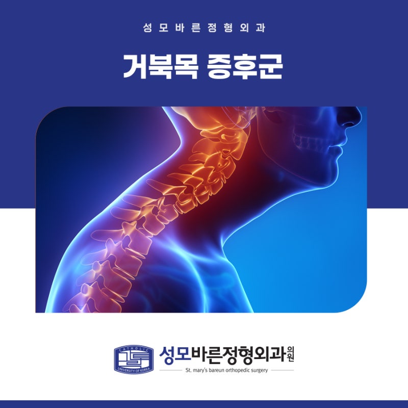 부개동 정형외과, 편두통 원인 거북목증후군의 증상 및 치료는 9