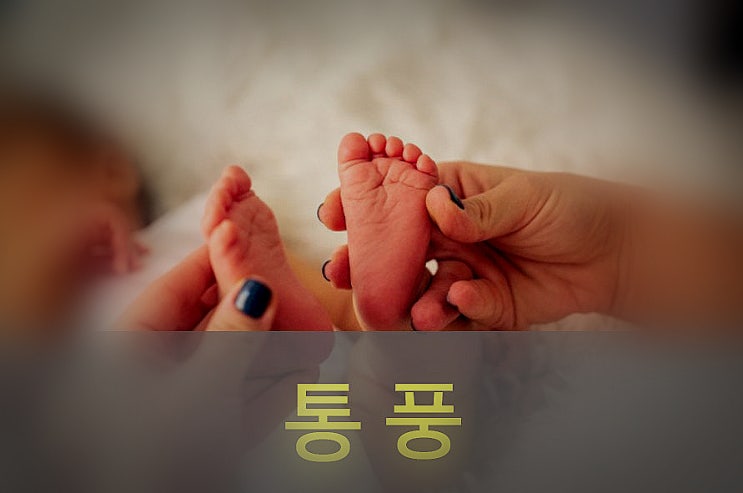  통풍 원인과 증상(통증), 요산 수치, 예방, 좋은 음식, 영양제