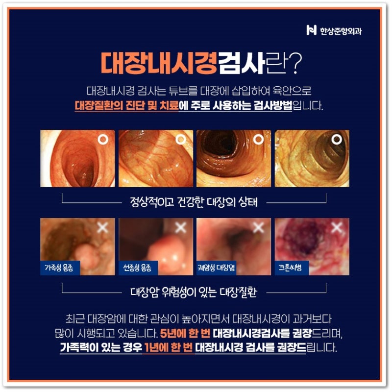 대장암 초기 증상(혈변, 점액변) 및 선종성 용종(용종), 대장내시경 2