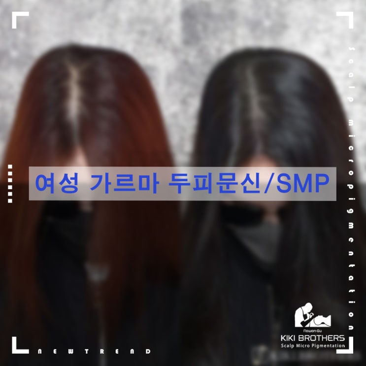  중랑 여성탈모커버!! 가르마탈모, 정수리 탈모커버 전문점 키키브라더스 노원