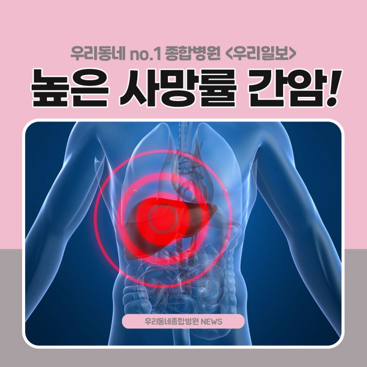  높은 사망률을 나타내는 간암 사전에 예방해보세요
