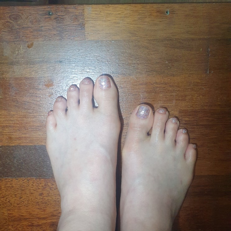 쌍촌동네일 바니네일, 글리터 페디 너무 이뻐요~