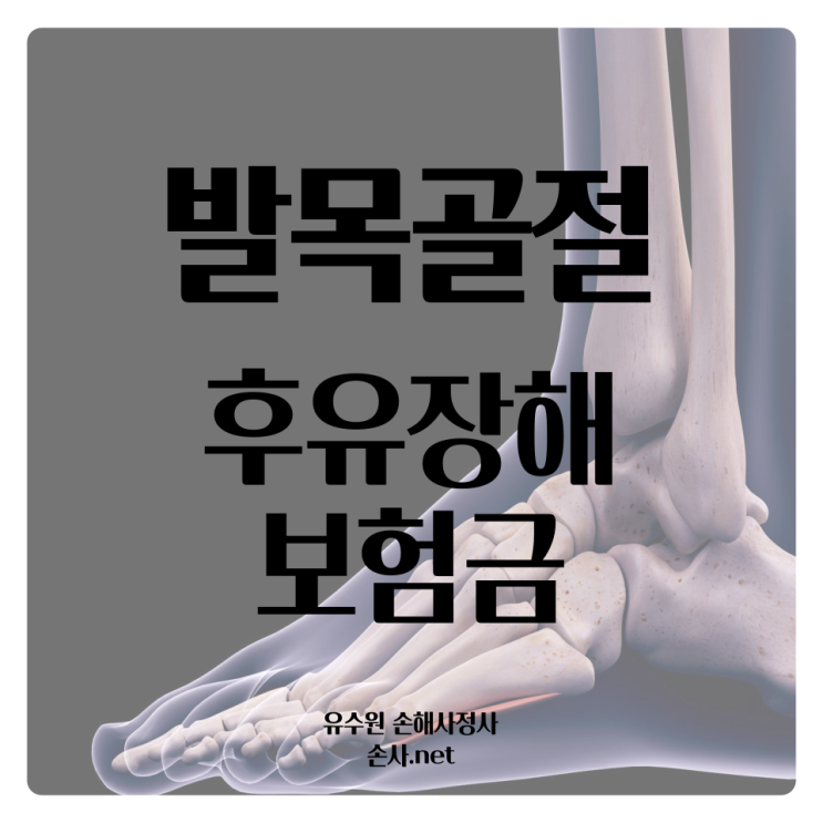  발목골절 후유장해 보험금 제대로 받을 수 있을까요?