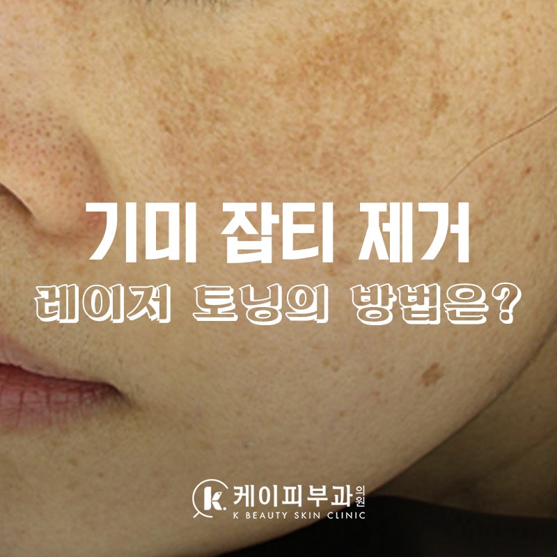 부산레이저토닝 얼룩제거 사례_피코토닝 사용이유 (흡수율문제)